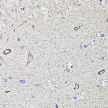 IHC-P analysis of mouse brain tissue using GTX32653 HIP1 antibody. Dilution : 1:100