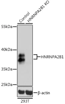 WB analysis of normal (control) and knockout (KO) 293T cell lysate using GTX32657 hnRNP A2B1 antibody. Dilution : 1:1000 Loading : 25microg per lane WB analysis of normal (control) and knockout (KO) 293T cell lysate using GTX32657 hnRNP A2B1 antibody. Dilution : 1:1000 Loading : 25microg per lane