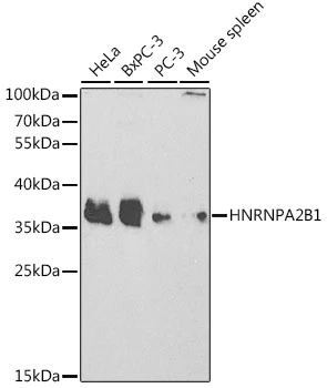 WB analysis of various sample lysates using GTX32657 hnRNP A2B1 antibody. Dilution : 1:1000 Loading : 25microg per lane