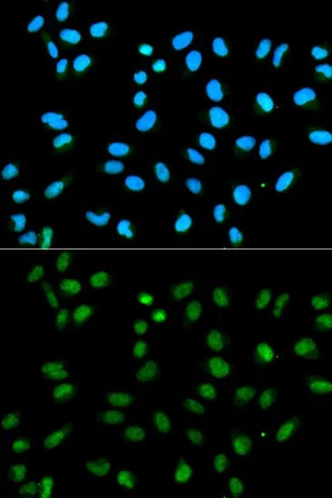 ICC/IF analysis of HeLa cells using GTX32657 hnRNP A2B1 antibody. Blue : DAPI