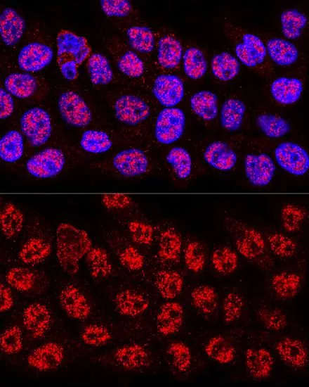 ICC/IF analysis of HeLa cells using GTX32657 hnRNP A2B1 antibody. Blue : DAPI Dilution : 1:400