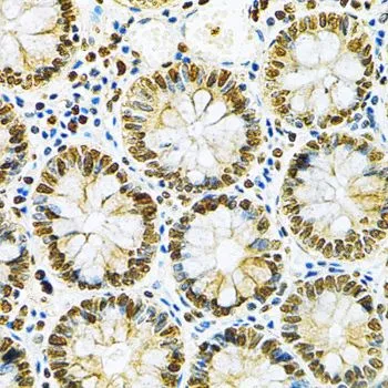 IHC-P analysis of human colon tissue using GTX32657 hnRNP A2B1 antibody. Dilution : 1:200