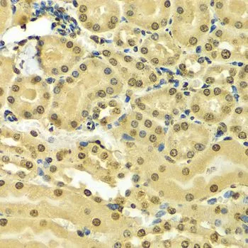 IHC-P analysis of mouse kidney tissue using GTX32657 hnRNP A2B1 antibody. Dilution : 1:100