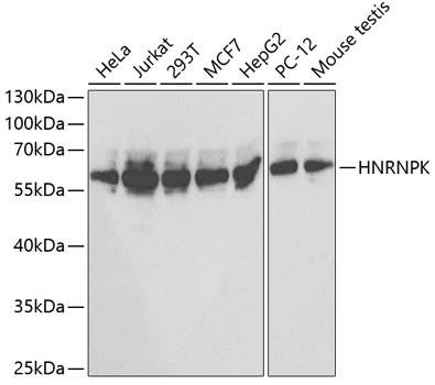 WB analysis of various sample lysates using GTX32658 hnRNP K antibody. Dilution : 1:1000 Loading : 25microg per lane WB analysis of various sample lysates using GTX32658 hnRNP K antibody. Dilution : 1:1000 Loading : 25microg per lane