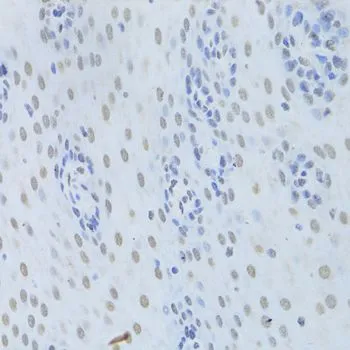 IHC-P analysis of human esophagus tissue using GTX32658 hnRNP K antibody. Dilution : 1:200