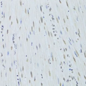IHC-P analysis of mouse esophagus tissue using GTX32658 hnRNP K antibody. Dilution : 1:200