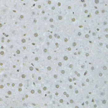 IHC-P analysis of rat liver tissue using GTX32658 hnRNP K antibody. Dilution : 1:200