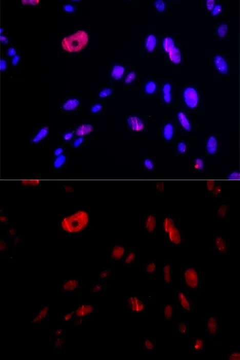 ICC/IF analysis of U2OS cells using GTX32662 HUS1 antibody. Blue : DAPI