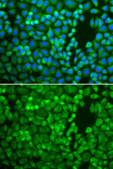 ICC/IF analysis of A549 cells using GTX32665 IDE antibody. Blue : DAPI