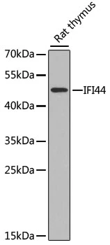 WB analysis of rat thymus tissue lysate using GTX32667 IFI44 antibody. The signal was developed with ECL plus-Enhanced. Dilution : 1:1000 Loading : 25microg per lane WB analysis of rat thymus tissue lysate using GTX32667 IFI44 antibody. The signal was developed with ECL plus-Enhanced. Dilution : 1:1000 Loading : 25microg per lane