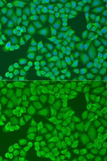 ICC/IF analysis of U2OS cells using GTX32667 IFI44 antibody. Blue : DAPI Dilution : 1:100