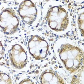 IHC-P analysis of human colon tissue using GTX32667 IFI44 antibody. Dilution : 1:100