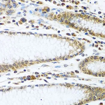 IHC-P analysis of human stomach tissue using GTX32667 IFI44 antibody. Dilution : 1:100