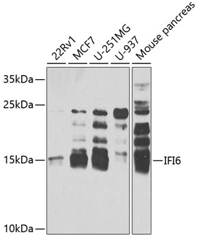 WB analysis of various sample lysates using GTX32668 IFI6 antibody. The signal was developed with ECL plus-Enhanced. Dilution : 1:1000 Loading : 25microg per lane WB analysis of various sample lysates using GTX32668 IFI6 antibody. The signal was developed with ECL plus-Enhanced. Dilution : 1:1000 Loading : 25microg per lane