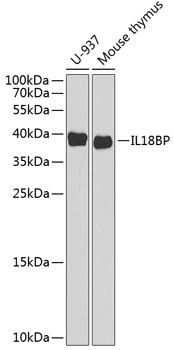 WB analysis of various sample lysates using GTX32676 IL18BP antibody. Dilution : 1:1000 Loading : 25microg per lane WB analysis of various sample lysates using GTX32676 IL18BP antibody. Dilution : 1:1000 Loading : 25microg per lane