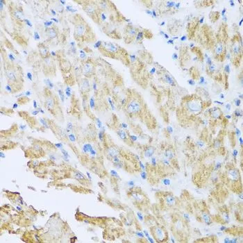 IHC-P analysis of mouse heart tissue using GTX32676 IL18BP antibody. Dilution : 1:100