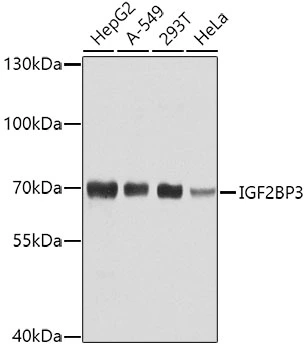 WB analysis of various sample lysates using GTX32680 IMP3 antibody. Dilution : 1:1000 Loading : 25microg per lane