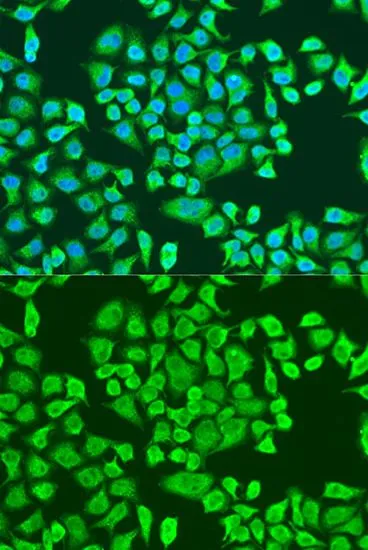 ICC/IF analysis of U2OS cells using GTX32680 IMP3 antibody. Blue : DAPI Dilution : 1:100