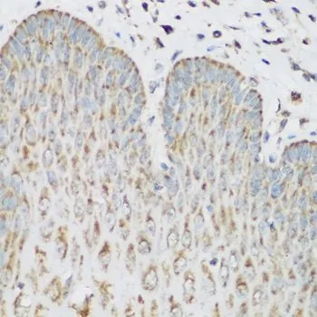 IHC-P analysis of human esophagus tissue using GTX32680 IMP3 antibody. Dilution : 1:200