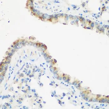 IHC-P analysis of mouse lung tissue using GTX32680 IMP3 antibody. Dilution : 1:200