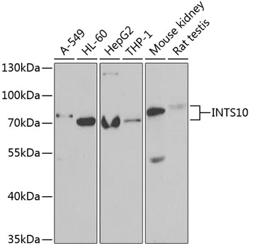 WB analysis of various sample lysates using GTX32682 INTS10 antibody. Dilution : 1:1000 Loading : 25microg per lane WB analysis of various sample lysates using GTX32682 INTS10 antibody. Dilution : 1:1000 Loading : 25microg per lane