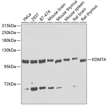 WB analysis of various sample lysates using GTX32688 JHDM1D antibody. Dilution : 1:1000 Loading : 25microg per lane WB analysis of various sample lysates using GTX32688 JHDM1D antibody. Dilution : 1:1000 Loading : 25microg per lane