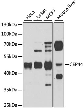 WB analysis of various sample lysates using GTX32692 KIAA1712 antibody. Dilution : 1:1000 Loading : 25microg per lane WB analysis of various sample lysates using GTX32692 KIAA1712 antibody. Dilution : 1:1000 Loading : 25microg per lane