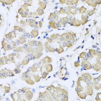 IHC-P analysis of human stomach tissue using GTX32695 L2HGDH antibody. Dilution : 1:100