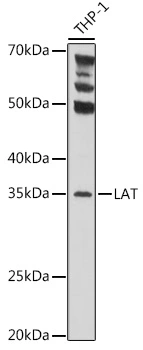 WB analysis of THP-1 cell lysate using GTX32700 LAT antibody. Dilution : 1:1000 Loading : 25microg per lane WB analysis of THP-1 cell lysate using GTX32700 LAT antibody. Dilution : 1:1000 Loading : 25microg per lane