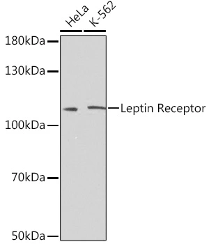 WB analysis of various sample lysates using GTX32703 Leptin Receptor antibody. Dilution : 1:500 Loading : 25microg per lane WB analysis of various sample lysates using GTX32703 Leptin Receptor antibody. Dilution : 1:500 Loading : 25microg per lane