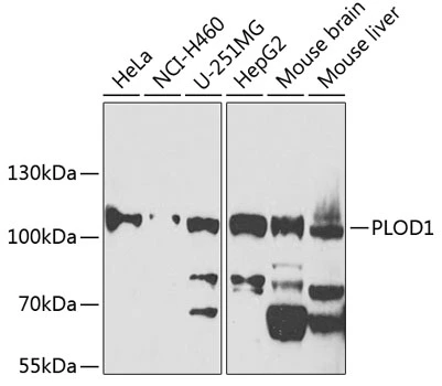 WB analysis of various sample lysates using GTX32707 LH1 antibody. The signal was developed with ECL plus-Enhanced. Dilution : 1:1000 Loading : 25microg per lane WB analysis of various sample lysates using GTX32707 LH1 antibody. The signal was developed with ECL plus-Enhanced. Dilution : 1:1000 Loading : 25microg per lane