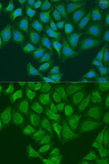 ICC/IF analysis of U2OS cells using GTX32707 LH1 antibody. Blue : DAPI Dilution : 1:100