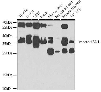 WB analysis of various sample lysates using GTX32709 Macro H2A.1 antibody. Dilution : 1:1000 Loading : 25microg per lane