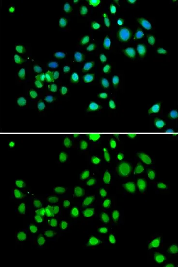 ICC/IF analysis of U2OS cells using GTX32709 Macro H2A.1 antibody. Blue : DAPI