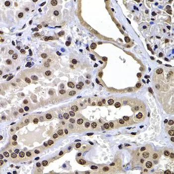 IHC-P analysis of human kidney tissue using GTX32709 Macro H2A.1 antibody. Dilution : 1:100