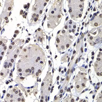 IHC-P analysis of human stomach tissue using GTX32709 Macro H2A.1 antibody. Dilution : 1:100