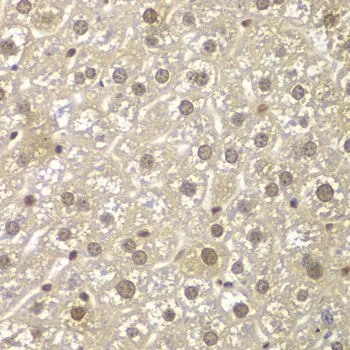 IHC-P analysis of mouse liver tissue using GTX32710 MAD1 antibody. Dilution : 1:100