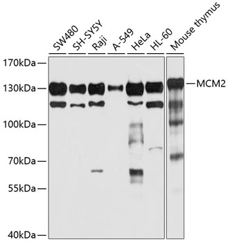 WB analysis of various sample lysates using GTX32716 MCM2 antibody. Dilution : 1:1000 Loading : 25microg per lane WB analysis of various sample lysates using GTX32716 MCM2 antibody. Dilution : 1:1000 Loading : 25microg per lane