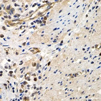 IHC-P analysis of human colon tissue using GTX32716 MCM2 antibody. Dilution : 1:200