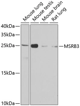 WB analysis of various sample lysates using GTX32730 MSRB3 antibody. Dilution : 1:1000 Loading : 25microg per lane WB analysis of various sample lysates using GTX32730 MSRB3 antibody. Dilution : 1:1000 Loading : 25microg per lane