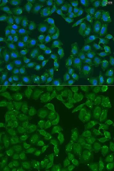 ICC/IF analysis of U2OS cells using GTX32730 MSRB3 antibody. Blue : DAPI for nuclear staining