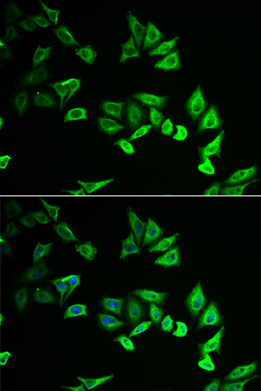 ICC/IF analysis of U2OS cell using GTX32734 MYOZ2 antibody. Blue : DAPI