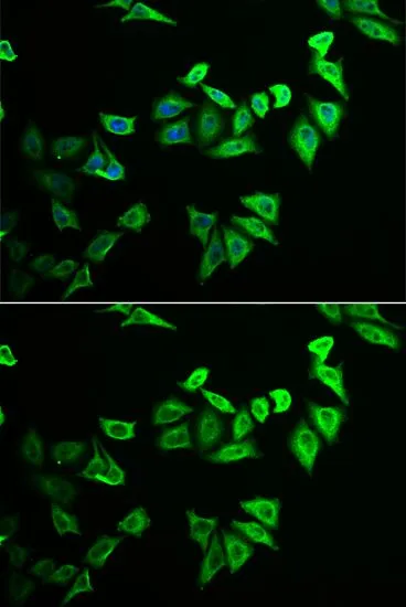 ICC/IF analysis of U2OS cells using GTX32734 MYOZ2 antibody. Blue : DAPI