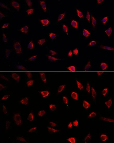 ICC/IF analysis of L929 cells using GTX32744 NEDD1 antibody. Blue : DAPI Dilution : 1:100