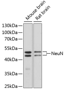 WB analysis of various sample lysates using GTX32746 NeuN antibody. The signal was developed with ECL plus-Enhanced. Dilution : 1:1000 Loading : 25microg per lane WB analysis of various sample lysates using GTX32746 NeuN antibody. The signal was developed with ECL plus-Enhanced. Dilution : 1:1000 Loading : 25microg per lane