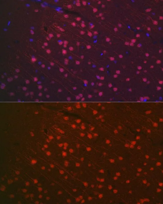 IHC-P analysis of rat brain tissue using GTX32746 NeuN antibody. Blue : DAPI Dilution : 1:100