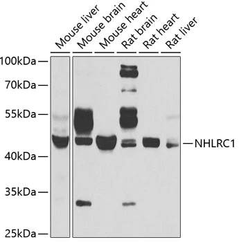 WB analysis of various sample lysates using GTX32750 NHLRC1 antibody. Dilution : 1:1000 Loading : 25microg per lane WB analysis of various sample lysates using GTX32750 NHLRC1 antibody. Dilution : 1:1000 Loading : 25microg per lane