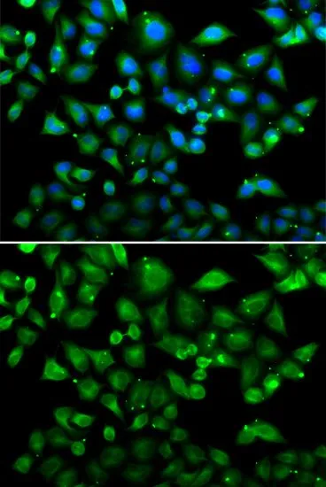 ICC/IF analysis of HeLa cells using GTX32750 NHLRC1 antibody. Blue : DAPI