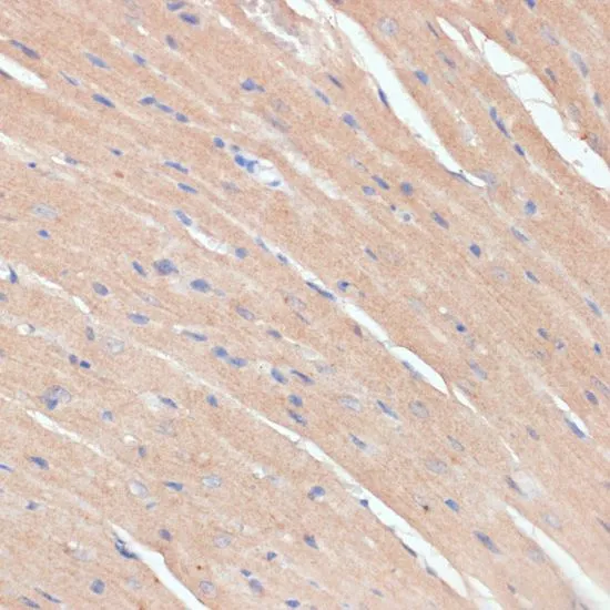 IHC-P analysis of mouse heart tissue using GTX32750 NHLRC1 antibody. Dilution : 1:100