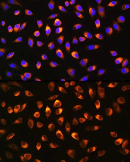 ICC/IF analysis of L929 cells using GTX32756 NQO1 antibody. Blue : DAPI Dilution : 1:100